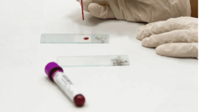 La démence peut être diagnostiquée par un test sanguin
