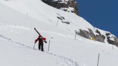 Des chirurgiens néerlandais relèvent les défis des vis Alpine